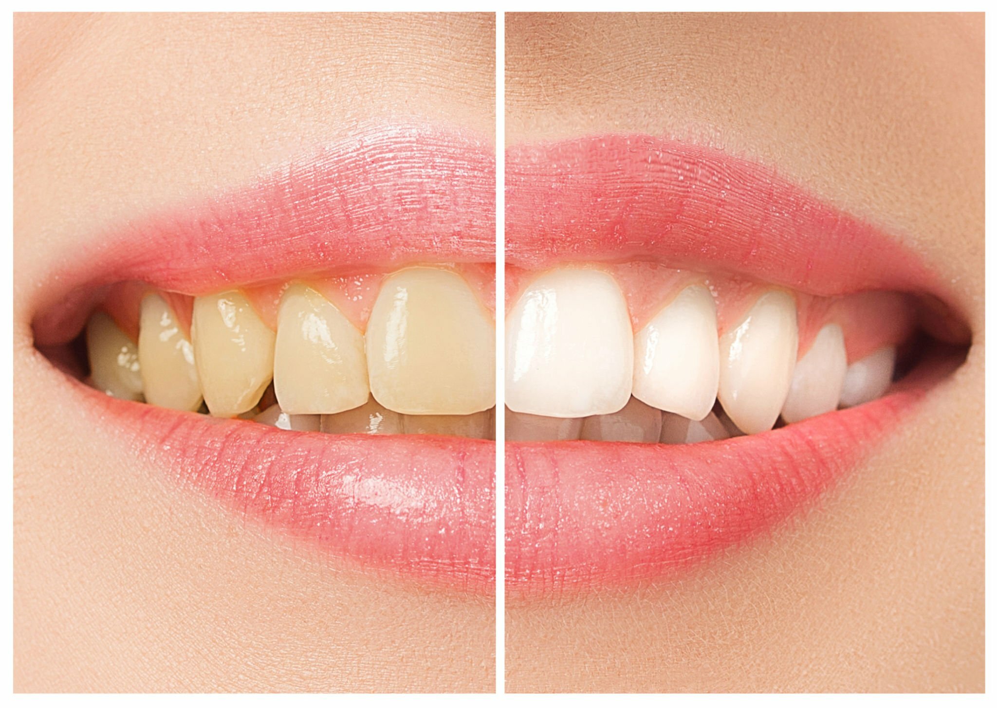 Is Cosmetic Dentistry Kansas City Worth The Investment?_FI