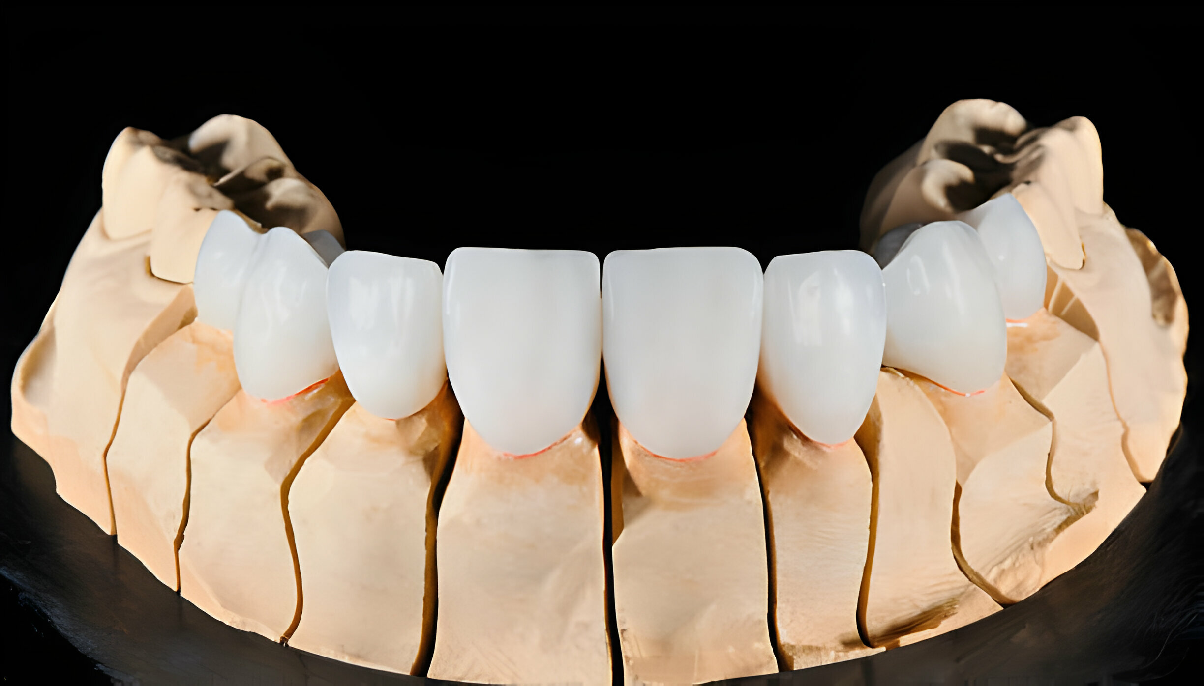 Restorative Dentistry Procedures: What You Need to Know_3