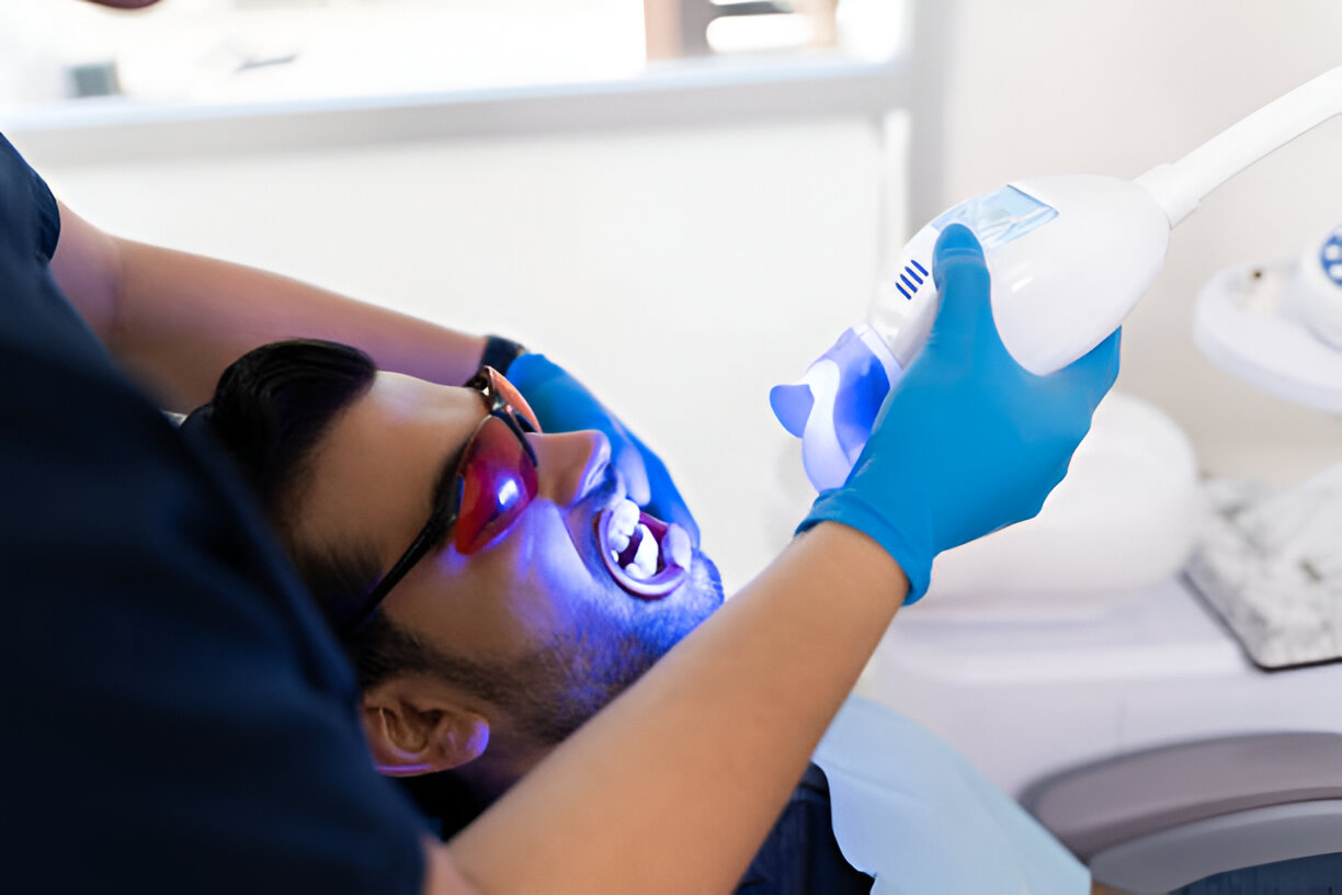 Professional Teeth Whitening: What to Expect and Why It Works_2