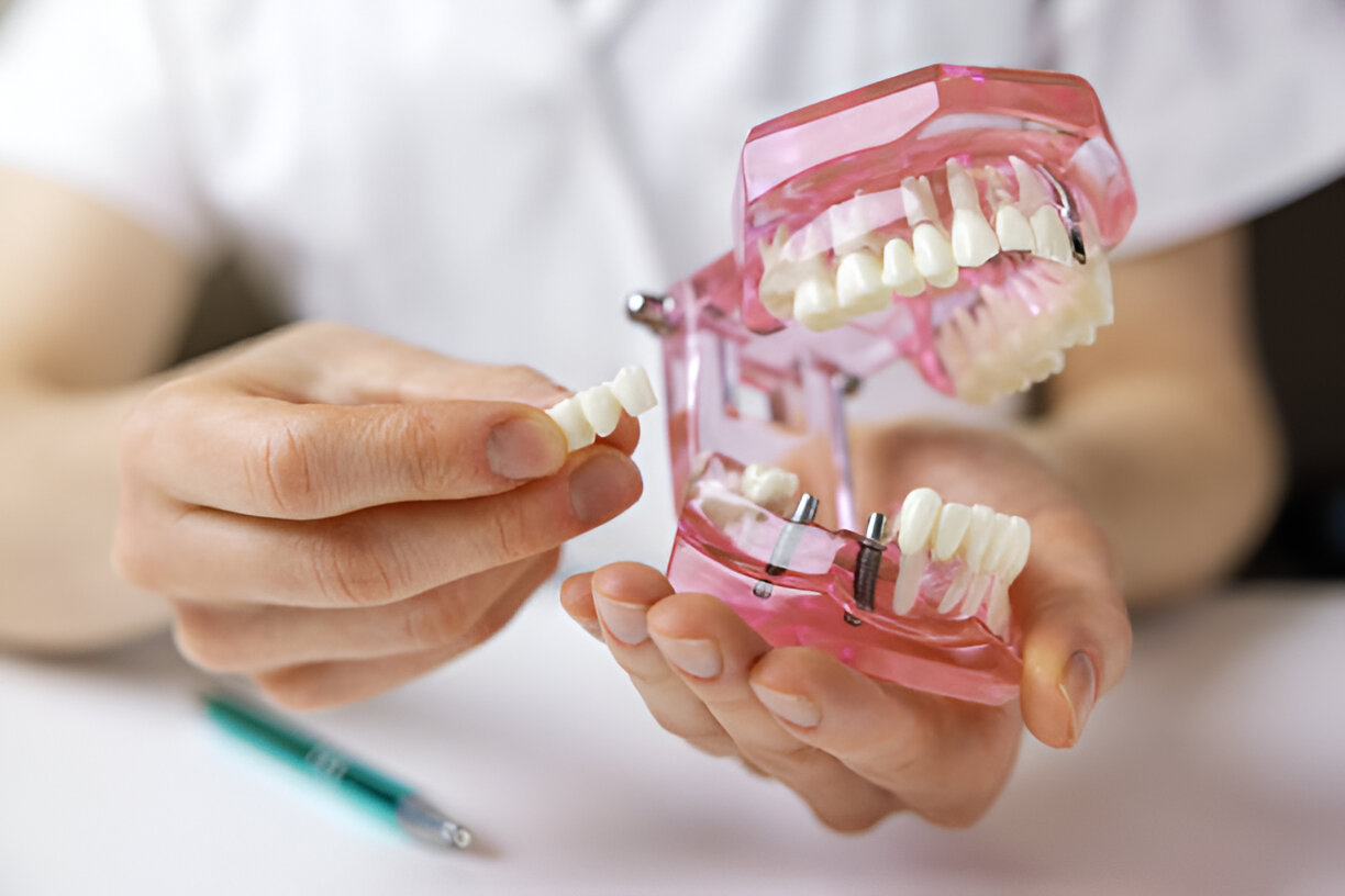 Transform Your Smile with Dental Implants at Cope Dentistry in Prairie Village, KS_3